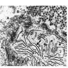 Image result for Isonema