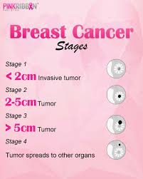 Image result for Breast Cancer Staging