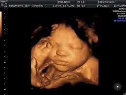 Maybe you would like to learn more about one of these? 36 Weeks 4d Scan Baby Moments 3d 4d Ultrasound Scan Centre Oxfordshire