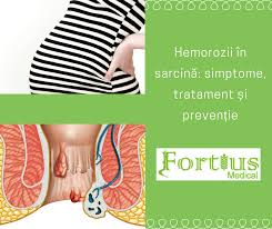 Ce remedii exista impotriva arsurilor in sarcina? Hemorozii In Sarcina Simptome Tratament Si Preventie