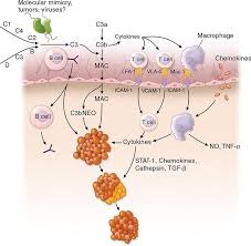 Image result for Polymyositis