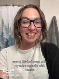 Braces Journey: Tips and Tricks for New Brace Wearers