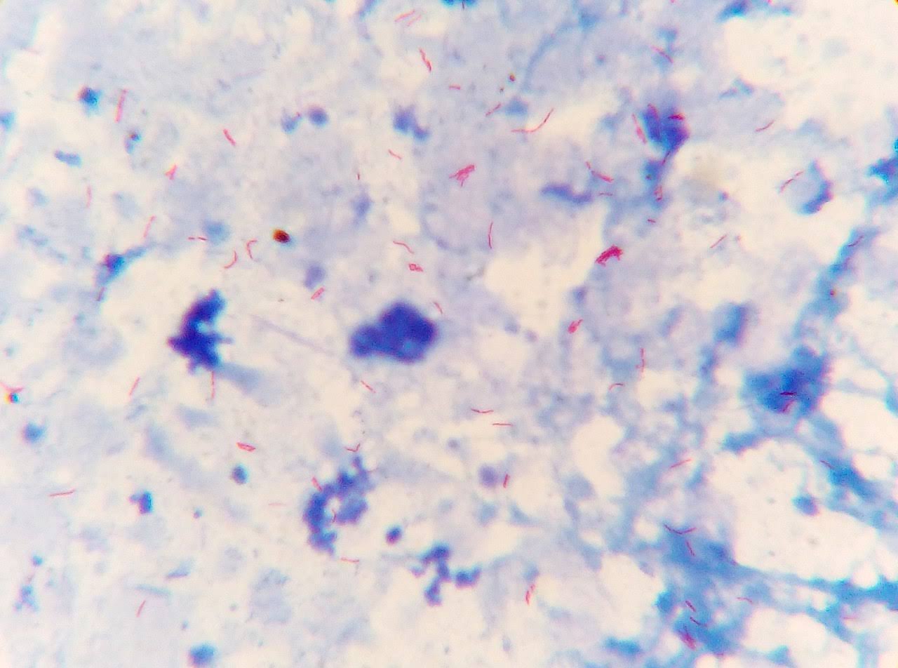 SPUTUM AFB product image