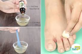 I have toe nail fungus on 1 toe so it is slowly (but. Use Tea Tree Oil For Fungal Infections Ringworm Jock Itch And More Fab How