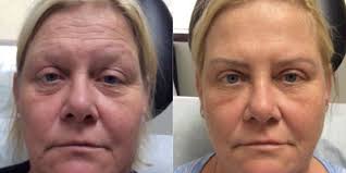Kristy Faye Fleming, MD, FAAD Reviews, Before and After Photos, Answers