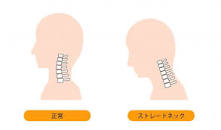 ストレートネック（スマホ首）の改善に！簡単にできるストレッチ ...