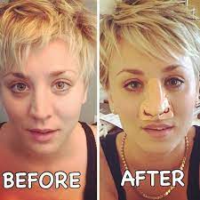 We did not find results for: Kaley Cuoco Mein Neues Ich Nach Der Nasen Op Gala De