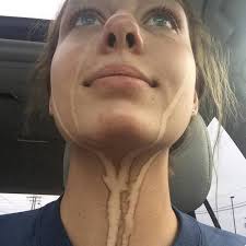 This 17-Year-Old Learned The Hard Way Not To Cry After Getting A Spray Tan