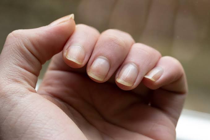Unexpected signs of aging that appear on nails