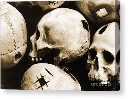 Image result for Skull Trephination