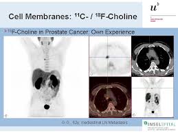 Maybe you would like to learn more about one of these? Petct In Oncology Pet Tracers Other Than Fdg