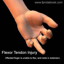 Image result for Hand Exam