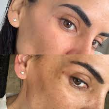 Musely the spot cream reviews. Musely Dark Spot Cream Reviews