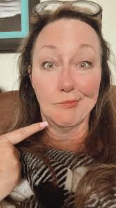 Ya'll how it the world did this happen over night? lol I'm about to be 54  yrs old in 10 days. I thought acne ended in my teens. Nope I got it