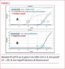 Methodes Diagnostiques Du Covid 19 Louvain Medical