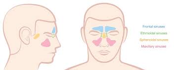 Headache Diagram Catalogue Of Schemas