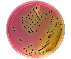 Image result for Shigella