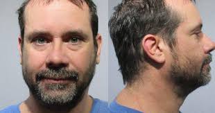 Suspect arrested in Boulder Hill facing domestic battery, interfering  charges