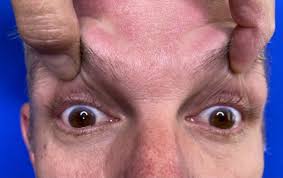 Image result for Oculovestibular Testing