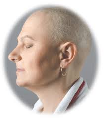 Patients can often expect their hair to begin regrowing soon after treatment has ended. Get Compensation From Taxotere Lawsuit Settlements Free Consultation On Your Taxotere Hair Loss Lawsuit Find A Skilled Attorney