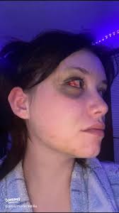 Understanding Domestic Violence: Signs, Impact, and Resources