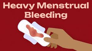 Image result for Menstrual Bleeding