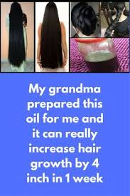 75 Best Monistat For Hair Ideas In 2021 Hair Growth Natural Hair Styles Grow Hair