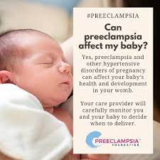 See full list on mayoclinic.org Can Pre Eclampsia Affect My Zuri Nzilani Foundation Facebook