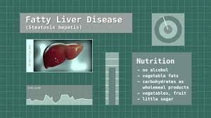Cirrhosis occurs due to necrosis of liver cells followed by fibrosis and nodule formation. Fatty Liver Disease Symptoms Treatment And Research Youtube