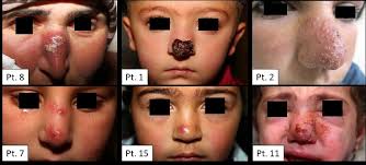 Head and Neck Pathology