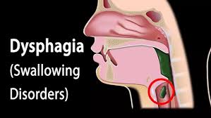 Image result for Swallowing
