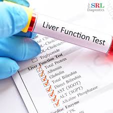 If any of the substances mentioned above are outside of the normal range, then it could be an indicator of underlying liver disease such as hepatitis. Liver Function Tests Or Lft Purpose Test Cost Treatments Healthcare Informational Blog Srl Diagnostics