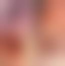 Image result for Colonoscopy in GI Bleeding