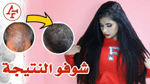 تطويل وزيادة كثافة الشعر ب٣ اشهر شوفو التجربة Hair Growth Method Youtube