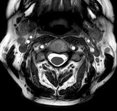 Check spelling or type a new query. Mrt Radiologie
