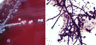 Image result for Dissotis congolensis