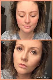 Hey, any recommendations for mixed skin?