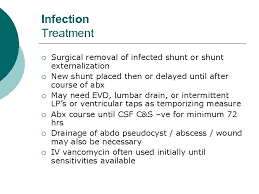 Hydrocephalus Ii Shunt Dysfunction And Neuroendoscopy Shelly Lwu