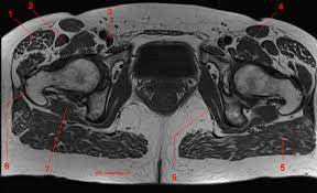 We did not find results for: Mri Of The Hip Detailed Anatomy W Radiology
