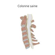 • vertèbre lombaire > de • vertèbre lombaire > en • vertèbre lombaire > es. Arthrose Cervicale Imed