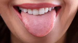 Why Does My Tongue Feel Funny Tindale Dental Penrith Dentist