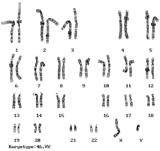 Redftaconko Karyotype Of Hemophilia