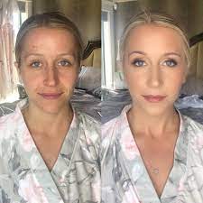 Kamloops Makeup Artist Bridal Before And After Acne Coverage Mother Of Bride Makeup Glamorous Wedding Makeup Fresh Wedding Makeup