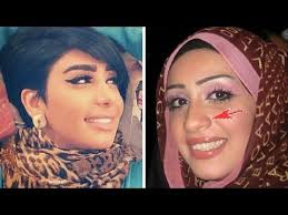 ممثلات خليجيات بعد عمليات تجميل الأنف وفروقات واضحة