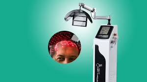 In one word yes, but allow me to explain how for those interested. Laser Hair Loss Treatment Health Beauty Turkey