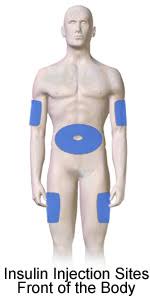 This will keep insulin from leaking out. How To Give An Insulin Injection Phartoonz