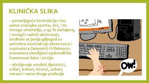 Liječnici su prvi put dijagnosticirali teniski lakat (ili lateralni epikondilitis) prije više od sto godina. 12 Epicondylitis Humeri Ili Teniski Lakat Medicinska Kola