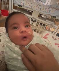 MILK NEEDED: My son has brain damage due to birth injury and is