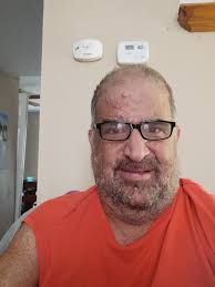 I have had pain for a few weeks but haven't had chance to get an  appointment with my GP until this week. He says it's Achilles tendonitus so  sent me for an