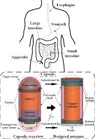 Image result for Wireless Capsule Endoscopy